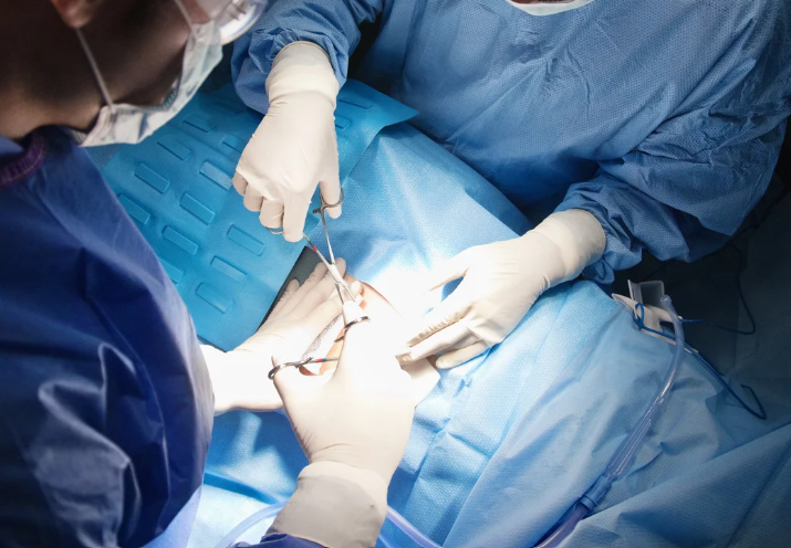 רשלנות רפואית בניתוח קיסרי